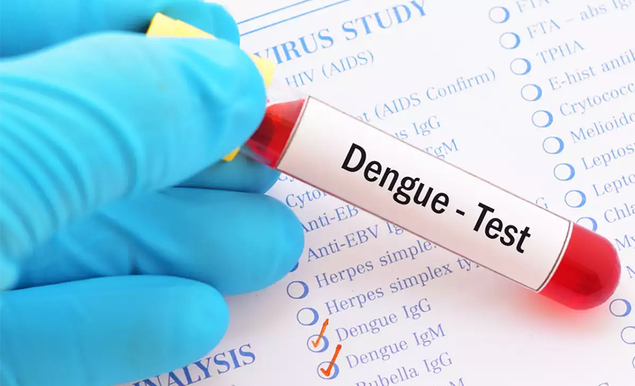 Dengue-Test